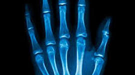 Timeline: Historia de la radiología