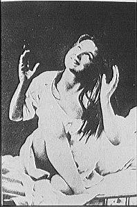 Charcot. Distinción entre Histeria y Epilepsia