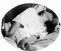 Charcot y las Parálisis Histéricas