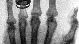 Timeline: Historia de la radiología