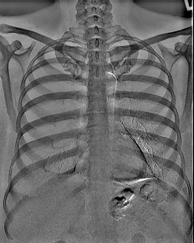 Imágenes tridimensionales mediante Rayos X