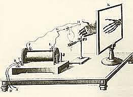 1930 Evento 4 Tubo de Rayos x