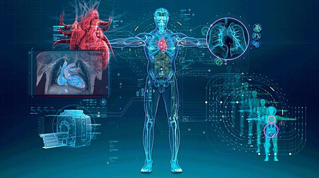 Inteligencia Artificial en Radiología