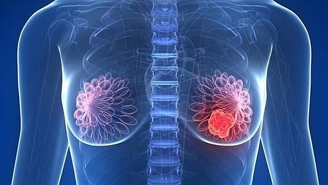 1999 Evento 5 Aplicaciones desde 1895 hasta nuestros Días de radiación Ionizante