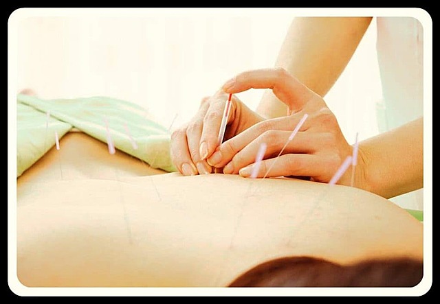 100 A.C. ACUPUNTURA CHINA, MEDICINA ALTERNATIVA