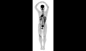 Primer escaneo cuerpo completo