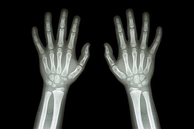 Llega la radiología a Colombia