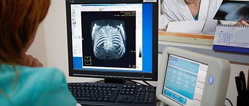 Radiografía digital