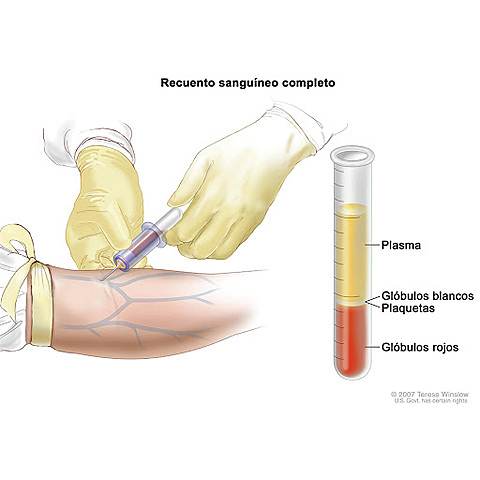 Primeras leucemias en radiólogos
