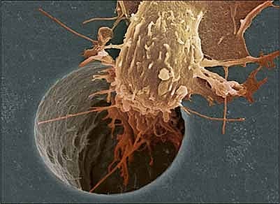 Lesiones en las moléculas de ADN