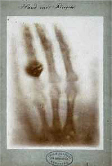 Primera Radiografía