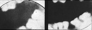 Friedrich Otto Walkhoff