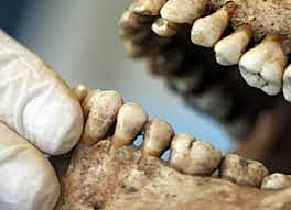 Primeros antecedentes de identificación odontológica