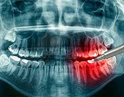 Radiología oral y maxilofacial