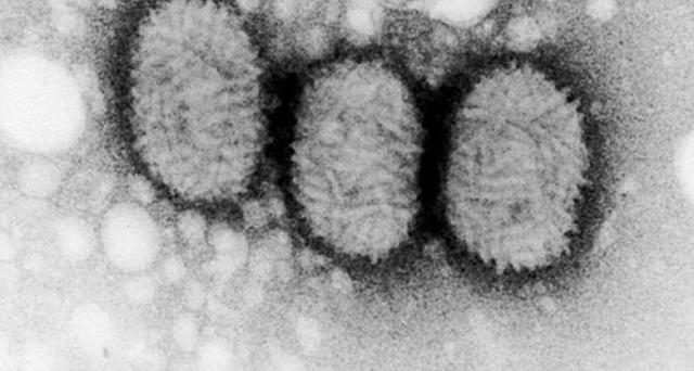 Tinción y microscopía