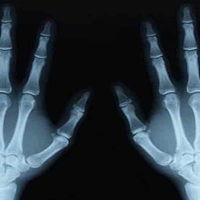 Timeline: Radiación ionizante