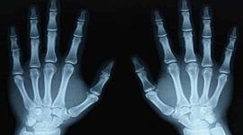 Timeline: Radiación ionizante