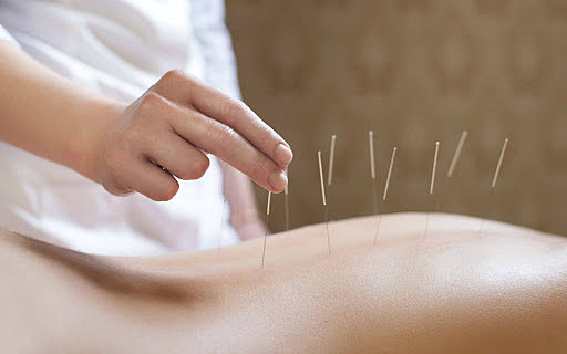 Medicina Tradicional China (Incluye Acupuntura)