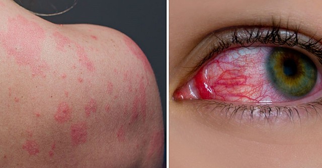 Siglo XV Creencias Religiosas Sobre la Sifilis