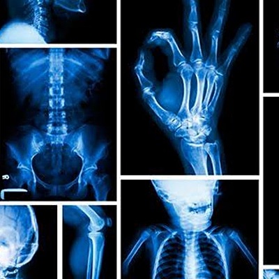 Timeline: Radiobiología y Radioprotección