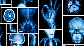Timeline: Radiobiología y Radioprotección