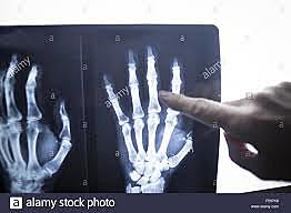 INTERES CIENTIFICO EN LOS RAYOS X