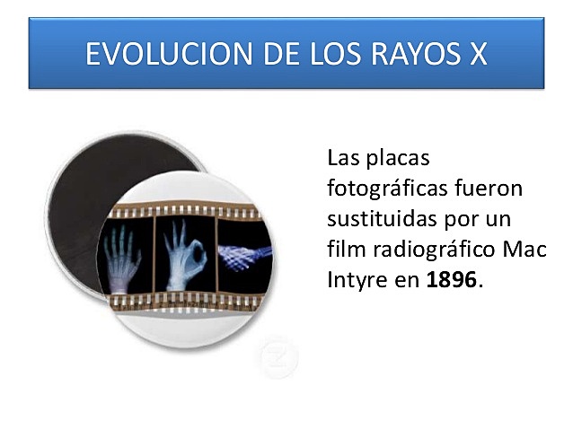 Evolucion de los rayos X