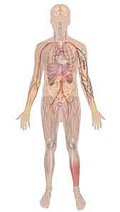 Dissection (Beliefs and results)