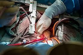 Open Heart Surgery