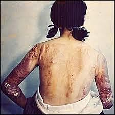 Efectos biologicos de la radiación