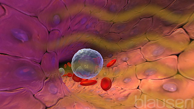 1993 Evento 4 Efectos Biológicos de la Radiación