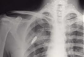 RADIOGRAFÍA RAYOS X