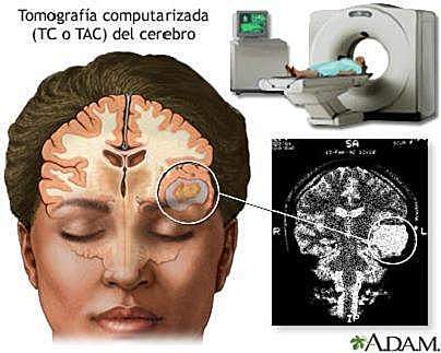 TOMOGRAFIA COMPUTARIZADA