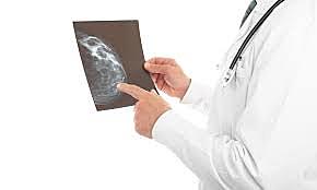 ESTUDIOS EPIDEMIOLOGICO