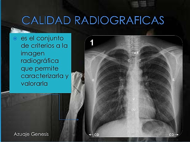 RECOMENDACIONES DE LOS AÑOS SESENTA