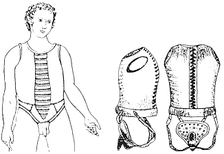 Methods Anti-Masturbation assaulting children's genitals died out