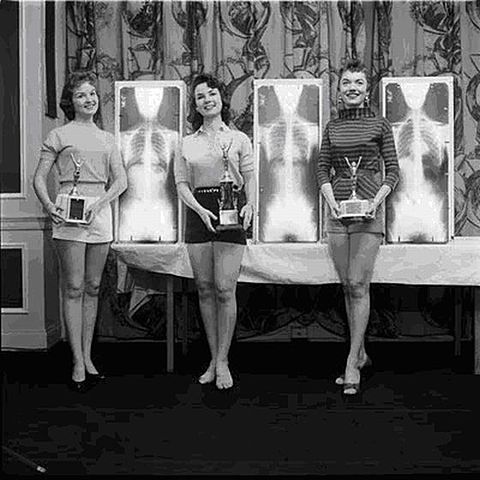 concurso de belleza con rayos x