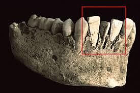 ODONTOLOGÍA PREHISPÁNICA