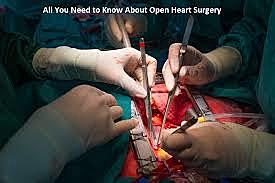 Open Heart Surgery
