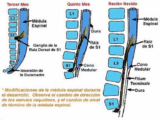 Cambios proposicionales de la medula espinal