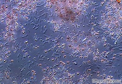 Carl Woese y George Fox