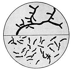 Robert Koch descubre el Mycobacterium tuberculosis.