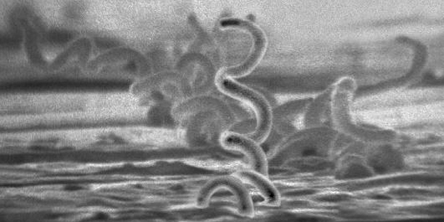 Agente causal de la sífilis identificado