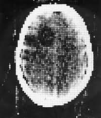 Atkinson Morley´s Hospital