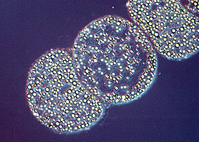 Bacteria gigante: Thiomargarita mamibiensis