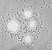 Secuenciación del genoma de Legionela