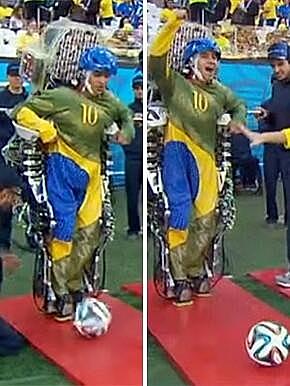 Prótesis reboticas y cerebros