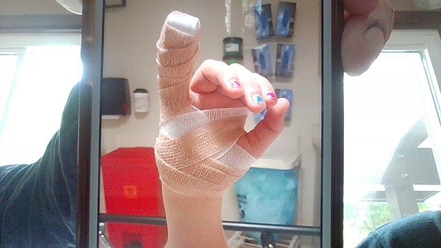 Slammed my finger in a car door