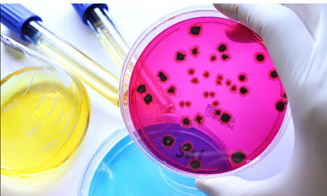 Microbiología- Luis pasteur