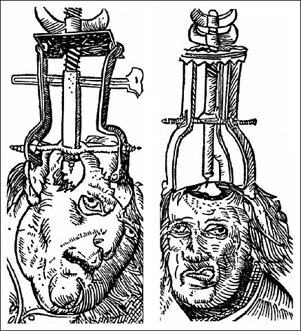 6500 BC - Earliest Evidence of Treatment - A Supernatural Theory